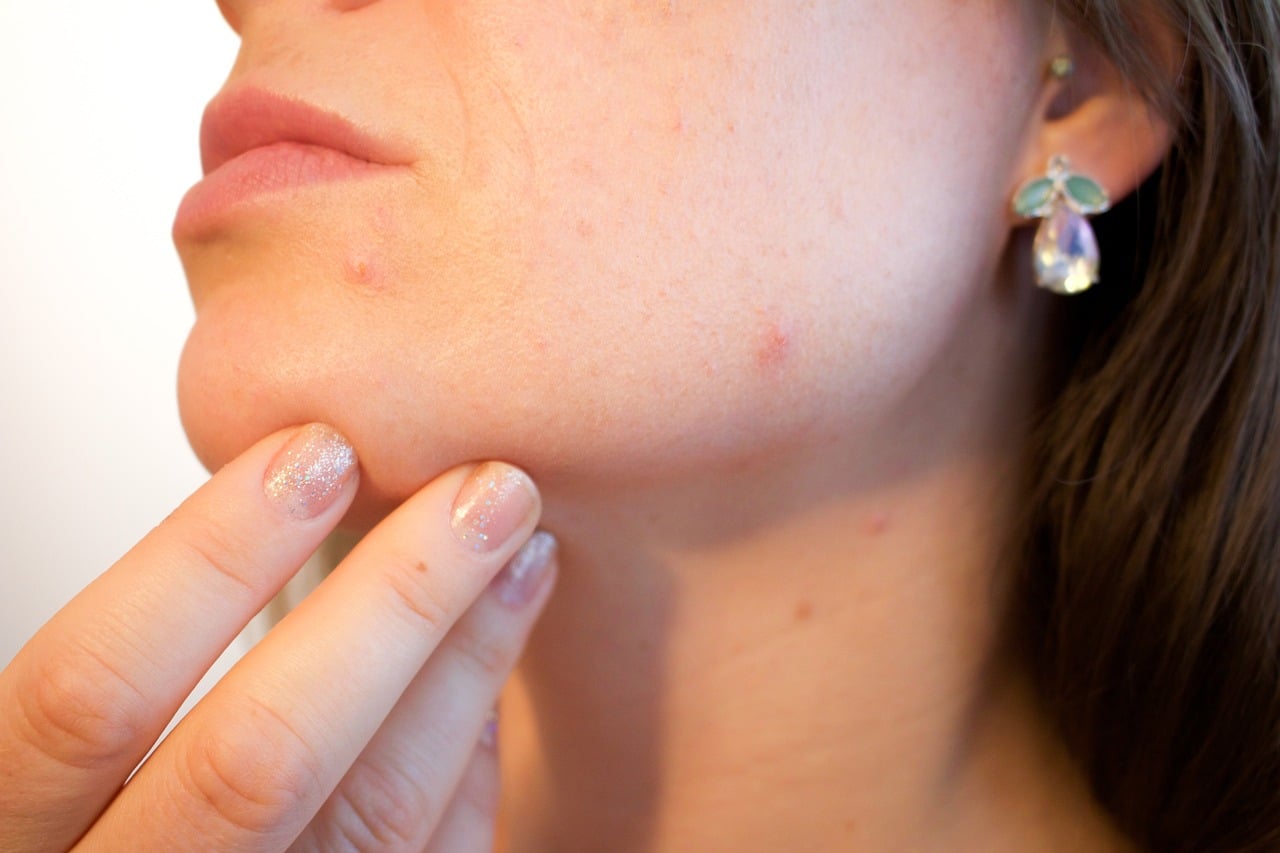 Les différentes raisons de contacter un dermatologue