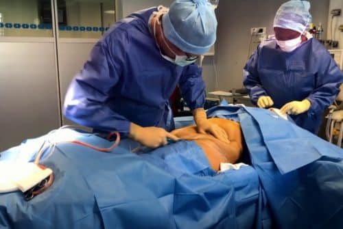 Abdominoplastie : Les commentaires des patients
