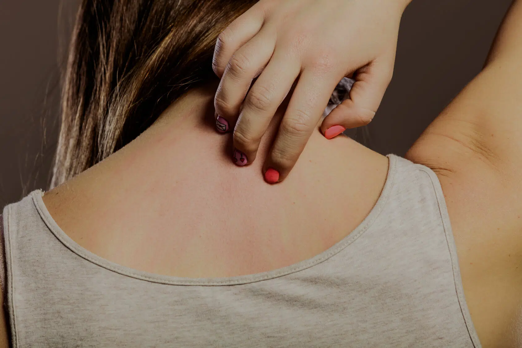 Comment calmer demangeaisons anales ?