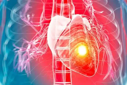 Les facteurs de risque des maladies cardiovasculaires : que faut-il savoir ?