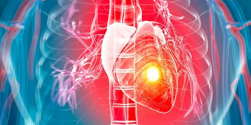 Les facteurs de risque des maladies cardiovasculaires : que faut-il savoir ?
