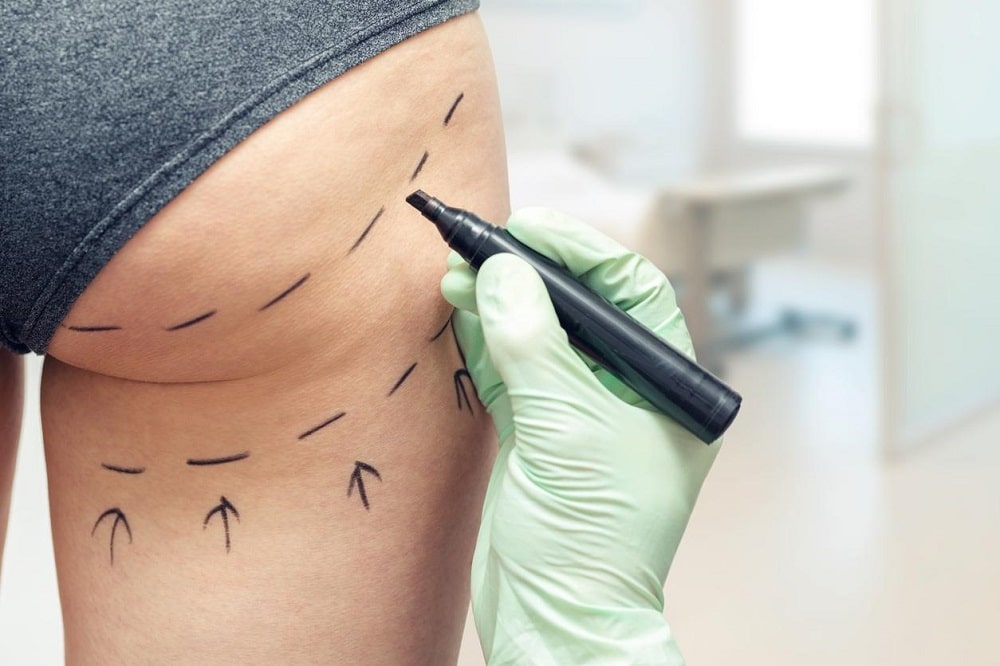 la chirurgie esthétique est dangereuse