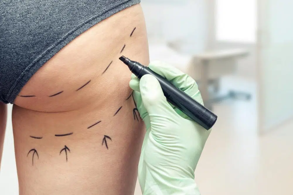 la chirurgie esthétique est dangereuse