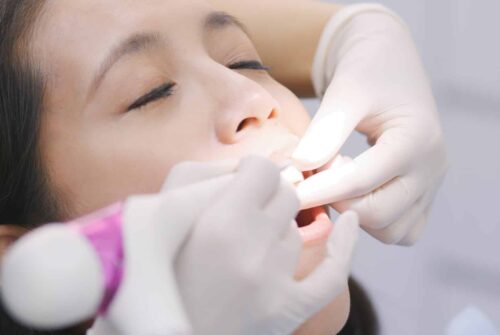 Urgence dentiste : comment soulager la douleur et obtenir des soins rapides ?